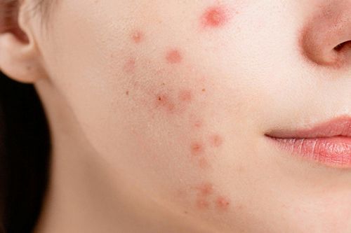 Dermatología clínica Valladolid